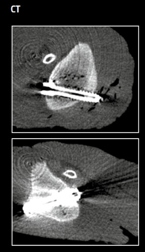 Comparison of imaging diagnostics